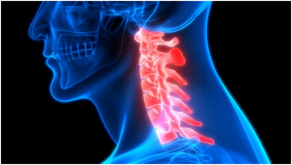 A dor no pescozo leva a dor nas costas