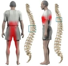 Saíntes na columna vertebral